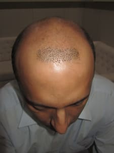 ניתוח ״הדגמה״